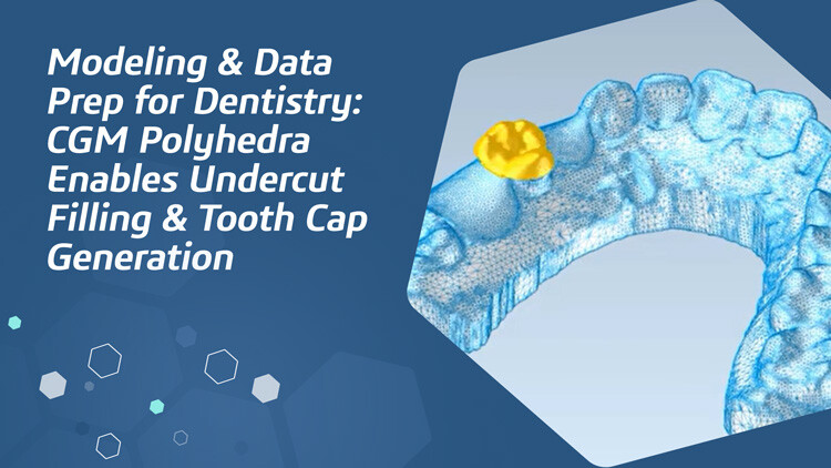 Modeling & Data Prep for Dentistry: CGM Polyhedra Enables Undercut Filling & Tooth Cap Generation